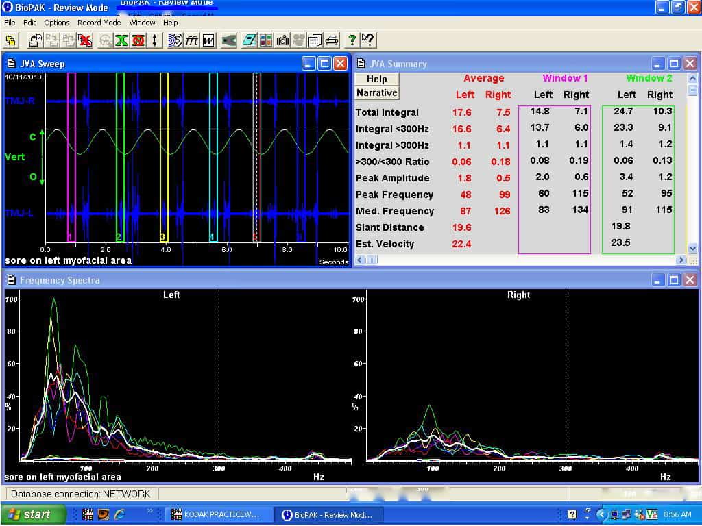 JVA sweep, summary, and frequency spectra to see the integrity of teeth scanned with the diagDent machine