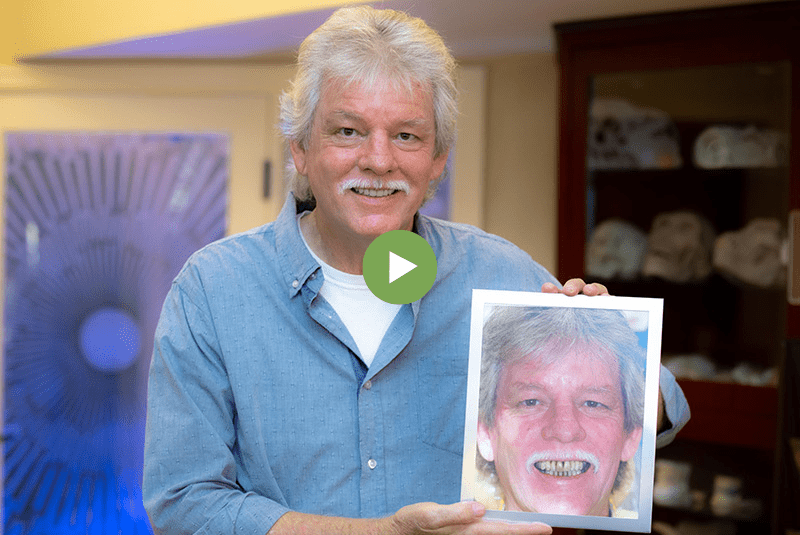 Man smiling after a successful implant supported dentures procedure while holding a before picture