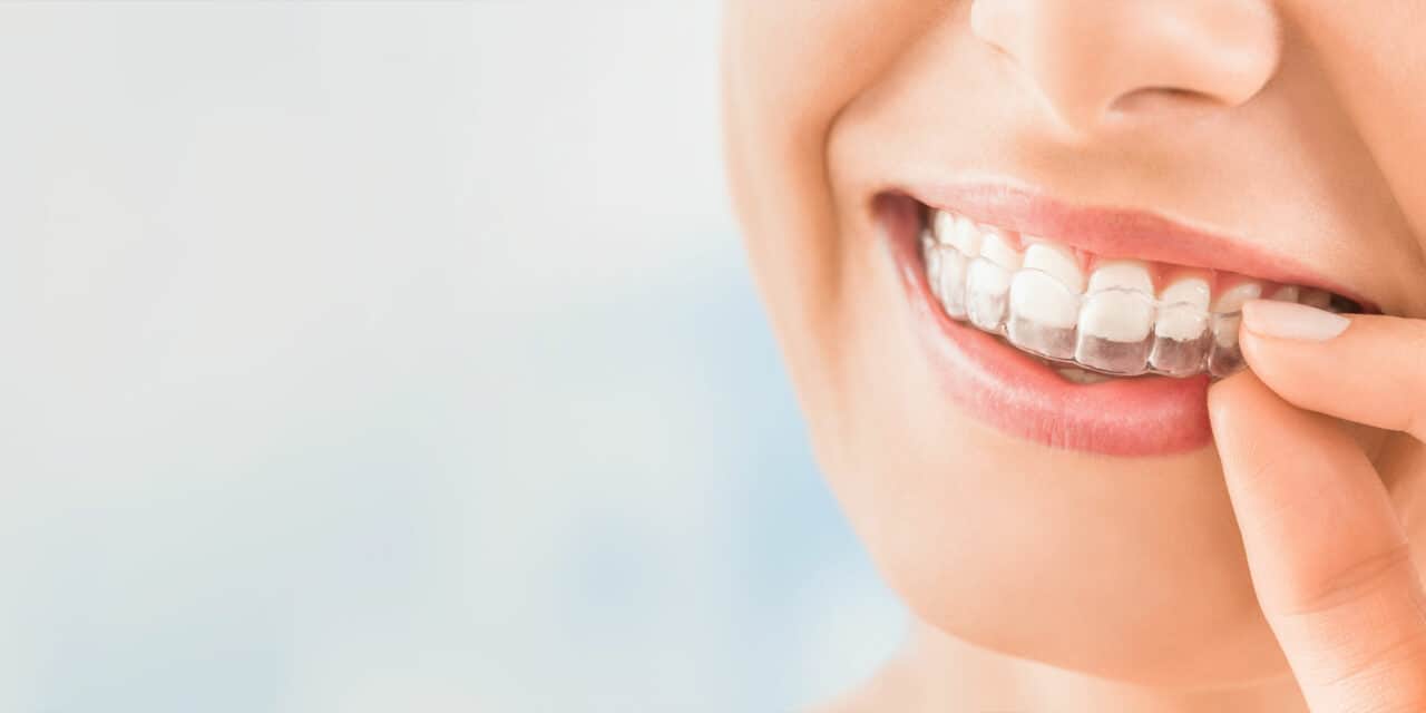 Woman happily putting Invisalign braces on