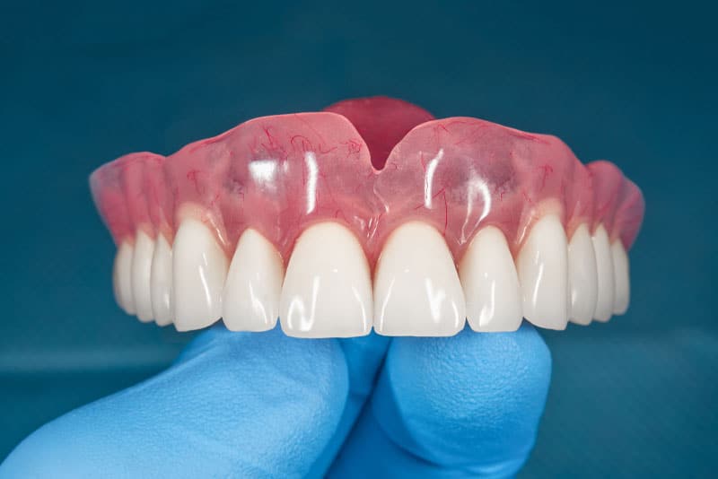 full-dentures-1