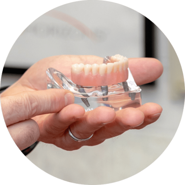 Dentist holding a model of a lower jaw denture as they explain how the procedure would go