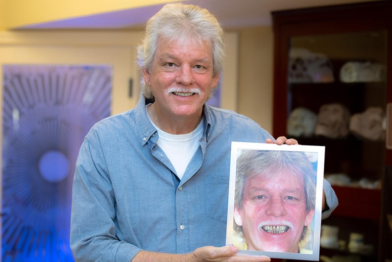 Patient smiling after a successful implant supported dentures procedure while holding a before picture
